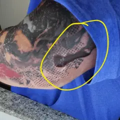 Odparzenie po second skin na ręce z tatuażem. Widoczny płyn i zaczerwienienie pod folią.